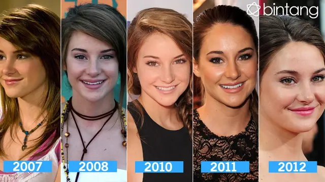 [Bintang] Metamorfosa Shailene Woodley, Idola Remaja yang Kena Skoliosis