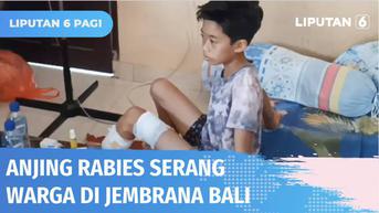 VIDEO: Sejumlah Warga Jembrana Bali Jadi Korban Gigitan Anjing yang Diduga Rabies