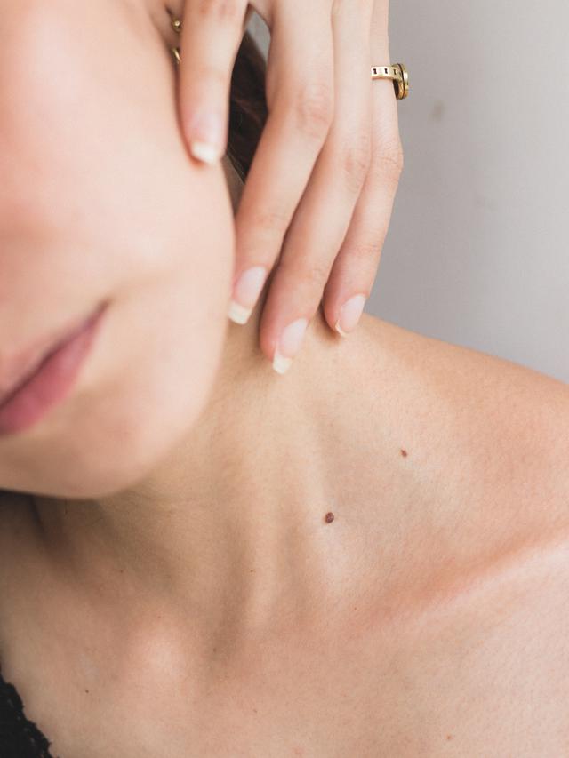 Kenali Kondisi Hiperhidrosis, Produksi Keringat Berlebihan yang Bikin Nggak Pede Saat Beraktivitas