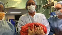 Kevin Daly, pasien di rumah sakit Lenox Hill yang semula mengira hanya mengalami buncit biasa kaget bukan main saat tahu ada tumor 13,6 kg di perutnya (Lenox Hill Hospital)