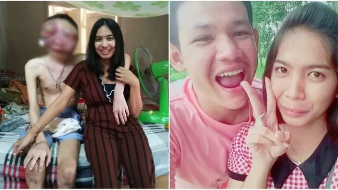 [Bintang] Kanker Mata