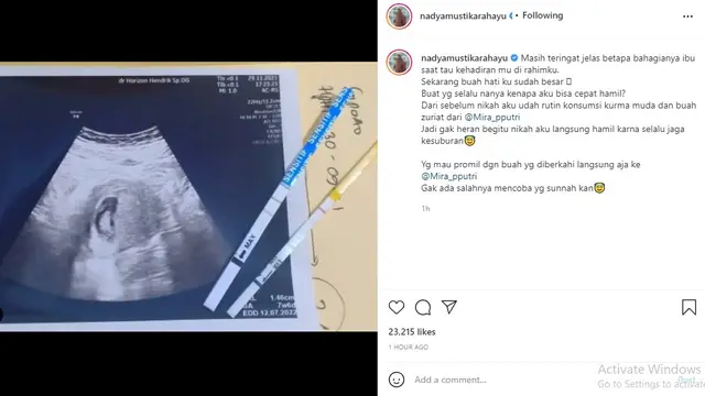 Rizki 2R - Nadya Mustika Rahayu (Foto: Instagram/@nadyamustikarahayu)