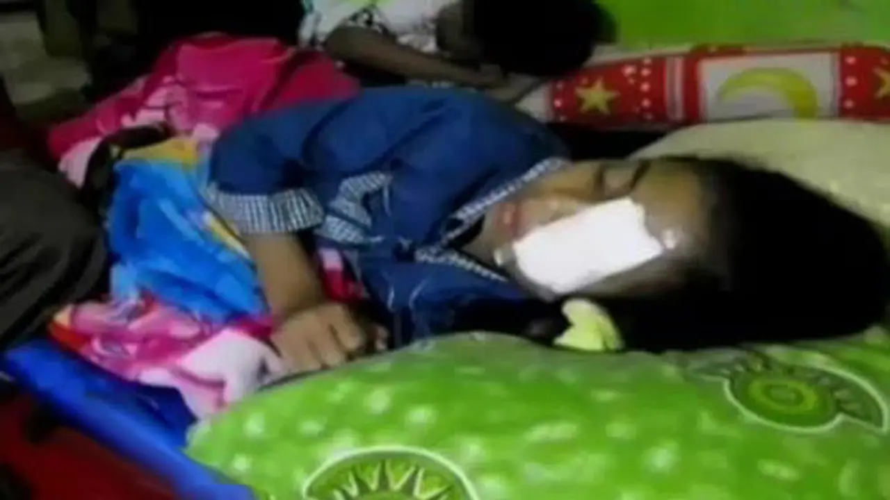 Buka Tutup Botol Soda, Mata Bocah Ini Nyaris Buta