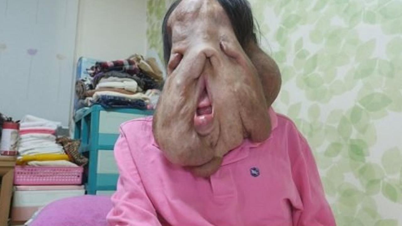 Wajahnya 'Mencair', Wanita Korea Ini Raih Simpati Netizen