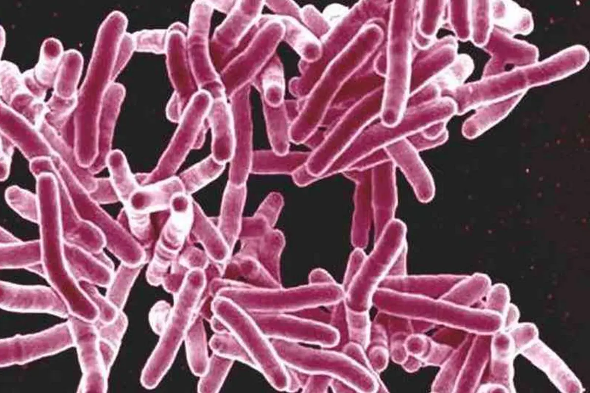 WHO: Kasus Tuberkulosis di Eropa Terus Menurun