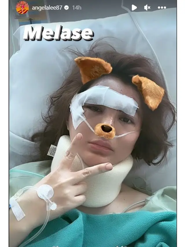 6 Potret Kondisi Angela Lee Pasca Alami Kecelakaan Mobil di Tol, Kaki Dipasang Pen