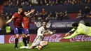 Ekspresi bintang Real Madrid, Cristiano Ronaldo saat dilanggar para pemain Osasuna, Ronaldo mencetak satu gol untuk kemenangan Real Madrid 3-1 pada lanjutan La Liga di El Sadar stadium, Pamplona, (11/2/2017). (AP/Alvaro Barrientos)