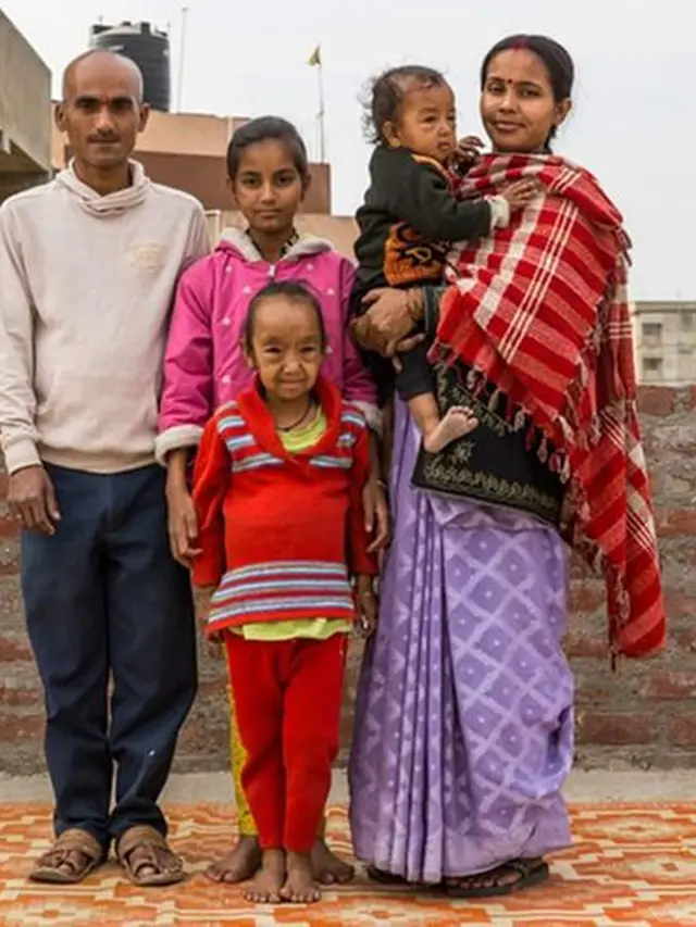 Kabar Terbaru Dua bersaudara India yang Terlihat Lebih Tua dari Orangtuanya/dok. Lie Gj Penang