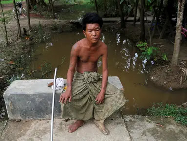 Khin Naing (50), duduk di dekat rumahnya di Yangon, 3 Juni 2016. Khin Naing merupakan seorang mantan tentara Myanmar yang kehilangan kedua kakinya pada 2009 setelah menginjak ranjau saat bertugas melawan kelompok etnis bersenjata. (REUTERS/Soe Zeya Tun)