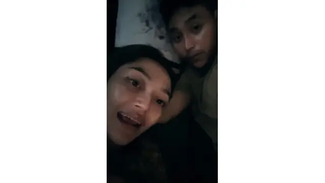 6 Potret Terbaru Siti Badriah Setelah Filler Bibir, Makin Seksi