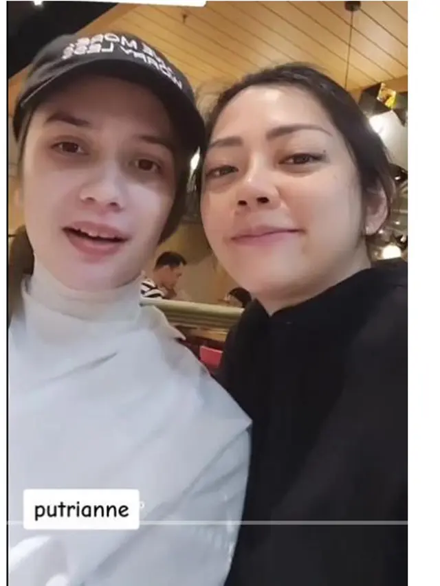 6 Potret Putri Anne Pamer Rambut Pendek Tanpa Hijab saat Live TikTok