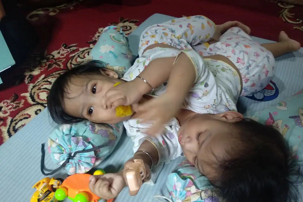 Dua bayi kembar siam asal Kendari, Aqila Dewi Sabila dan Azila Dewi Sabrina.(Liputan6.com/Ahmad Akbar Fua)