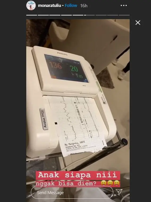 6 Momen Lahiran Anak Keempat Mona Ratuliu, Penuh Haru Bareng Suami