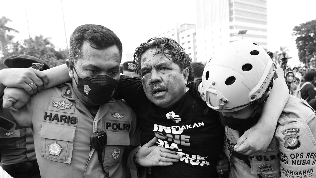 SILO Ade Armando Dirawat di RS Siloam Jakarta Usai Dipukuli Massa dalam Demo 11 April - News Liputan6.com