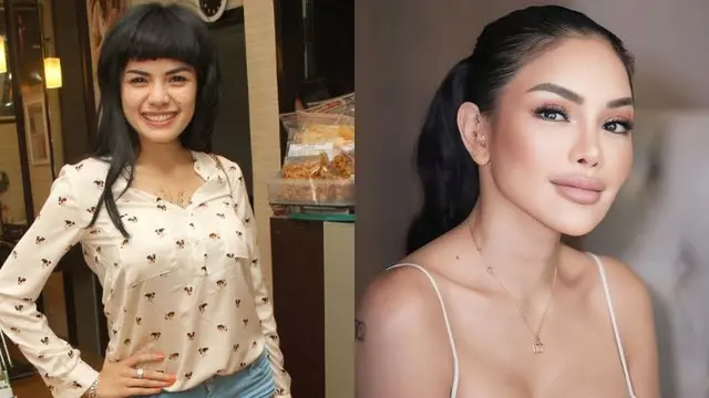 Operasi kelopak Mata