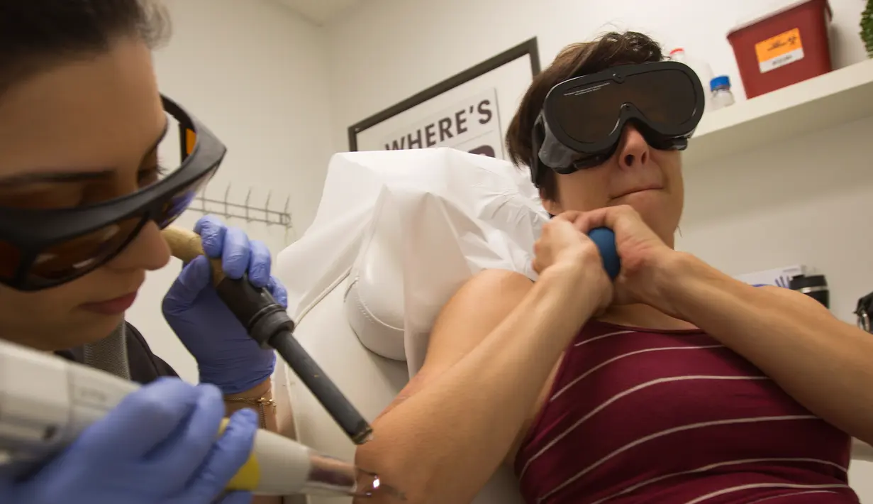 Jill Crenshaw menahan panas dan sakit ketika tato pada lengan kanannya dihapus menggunakan laser di klinik Dr. Tatoff, California, Rabu (11/5). Dengan metode laser tato tidak langsung hilang, namun hanya memudar. (AFP PHOTO/DAVID McNew)