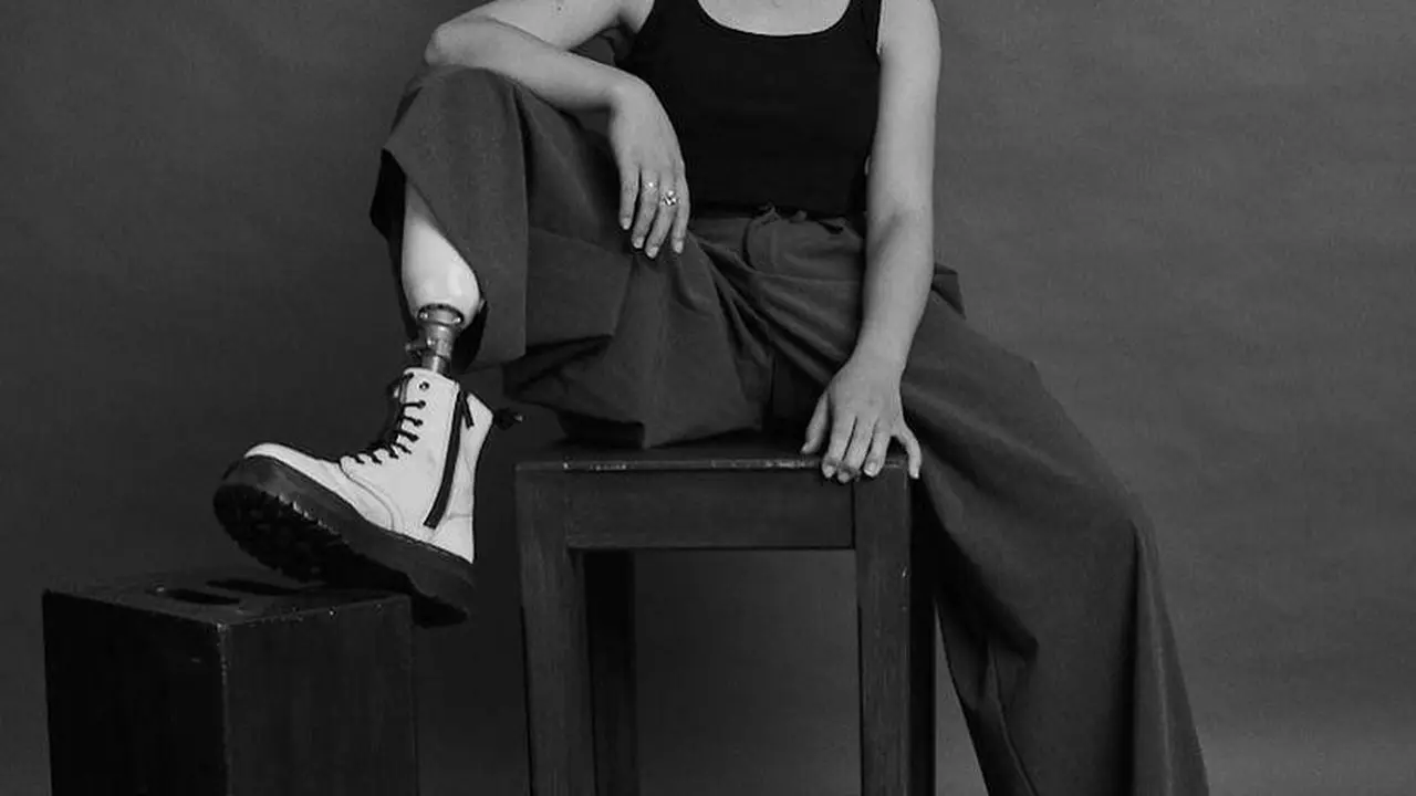 Kisah Remaja Kehilangan Kaki karena Kanker, Kini Sukses Jadi Model Brand Ternama