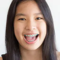 Usia Berapa Anak Boleh Memakai Kawat Gigi? (Toey Toey/Shutterstock)