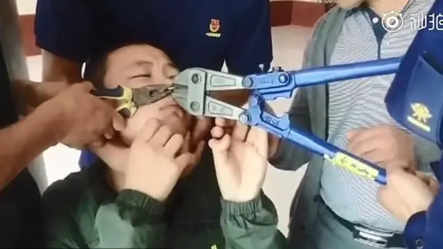 Iseng Bermain Gantungan Kunci di Hidung, Bocah Ini Akhirnya Menyesal