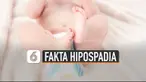 Berikut beberapa fakta hipospadia seperti yang dialami mantan atlet voli putri Aprilia Manganang.