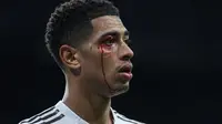 Krisis Real Madrid Makin Parah: Jude Bellingham Jadi Tumbal Kekalahan dari Celta Vigo, Tinggalkan Lapangan dengan Pelipis Berdarah