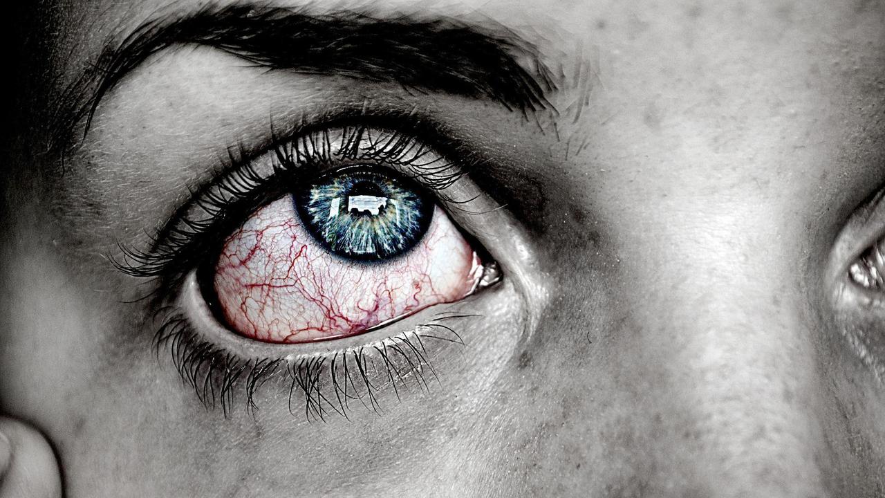 Ilustrasi pembuluh darah mata pecah