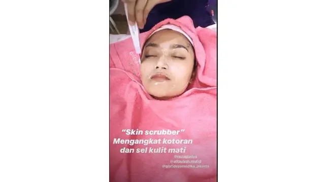 6 Potret Terbaru Siti Badriah Setelah Filler Bibir, Makin Seksi