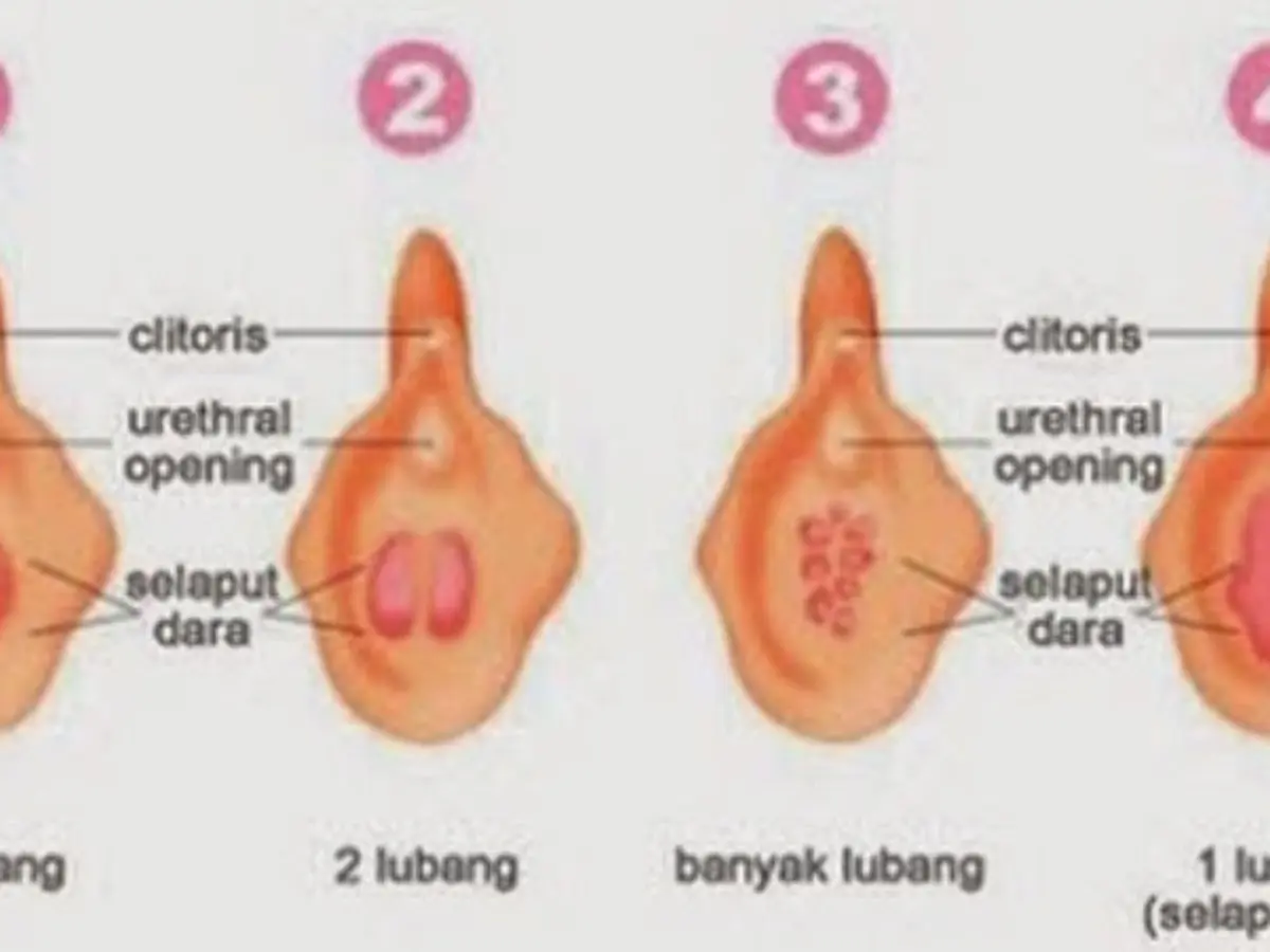 6 Fakta Menarik tentang Selaput Dara - Health Liputan6.com