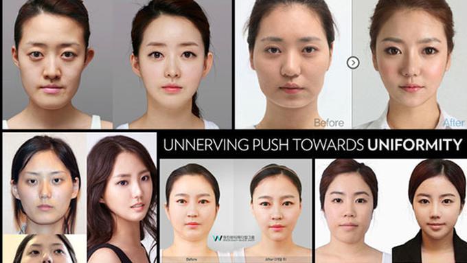 Gadis Korea Operasi Plastik Sendiri Karena Tidak Punya ...
