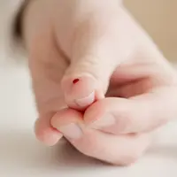 Ilustrasi Luka Credit: pexels.com/Artem