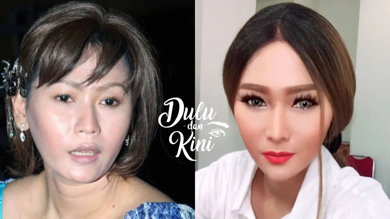Dulu dan Kini: Transformasi Inul Daratista yang Bikin Pangling, Sekarang Super Kece!