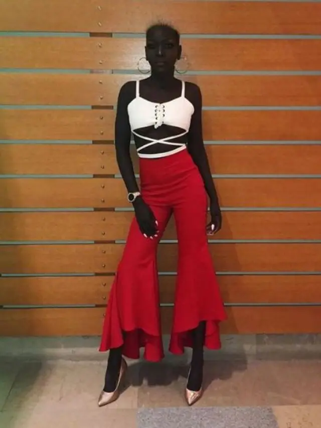 [Bintang] Dibully karena Kulitnya yang Hitam, Cewek Ini Sukses Jadi Model