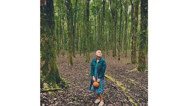 Sudah Jalani Kemoterapi Kedua, Ini 6 Potret Terbaru Feby Febiola