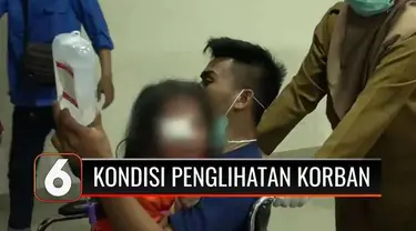 Begini penjelasan tim dokter usai operasi, terkait kondisi penglihatan bocah perempuan yang alami tindak kekerasan. Sementara itu, polisi telah menetapkan kedua orang tua korban menjadi tersangka.