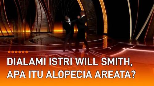VIDEO: Dialami Istri Will Smith, Apa itu Alopecia Areata?