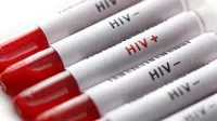 Meski sepele, kamu nggak boleh mengabaikan tanda seseorang terkena HIV ini ya. (Sumber Foto: POZ Magazine)