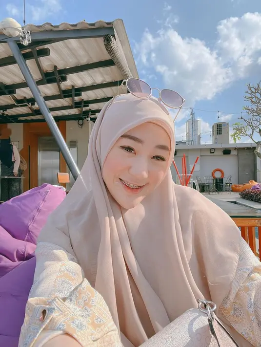 Larissa Chou tersenyum saat berselfie dengan kaca mata di kepalanya. Sebelum dikabarkan dekat dengan Rio Haryanto, Larissa Chou sempat dijodohkan dengan Zikri Daulay. (Instagram/Larissachou)