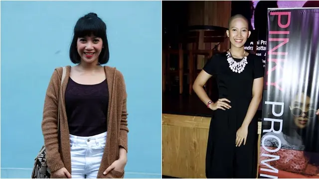 Demi Peran, 5 Artis Cantik Ini Rela Tampil Botak