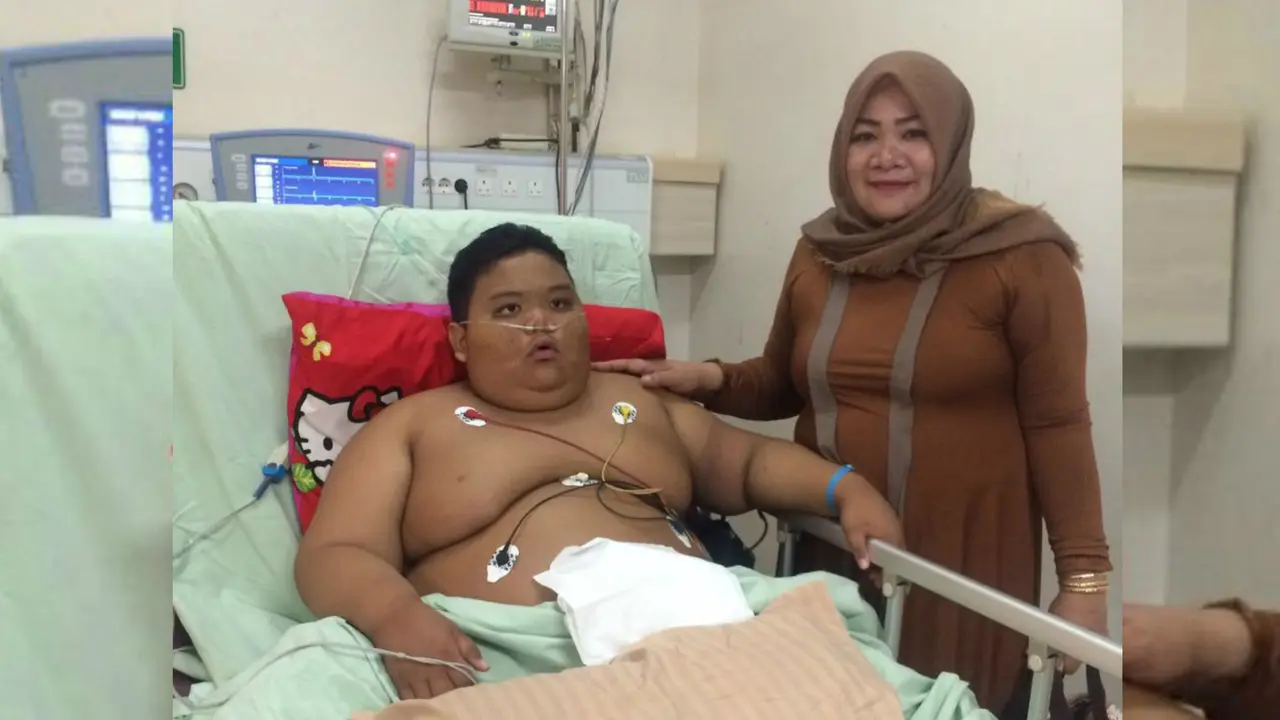 Bocah Obesitas asal Palembang