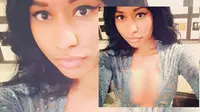 Cerita Nicki Minaj Soal Aborsi Ketika SMP