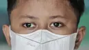 Potret anak berinisial R (9) dengan kondisi mata sebelah kanan yang telah diganti di Rusunawa Marunda, Jakarta Utara, Rabu (9/3/2022). Pencemaran debu batu bara mengakibatkan sejumlah penghuni mengalami sesak nafas, gatal-gatal. (merdeka.com/Iqbal S. Nugroho)