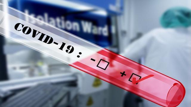 Bank NTT dan BRI Jadi Klaster Baru Penyebaran Covid-19 di NTT ...