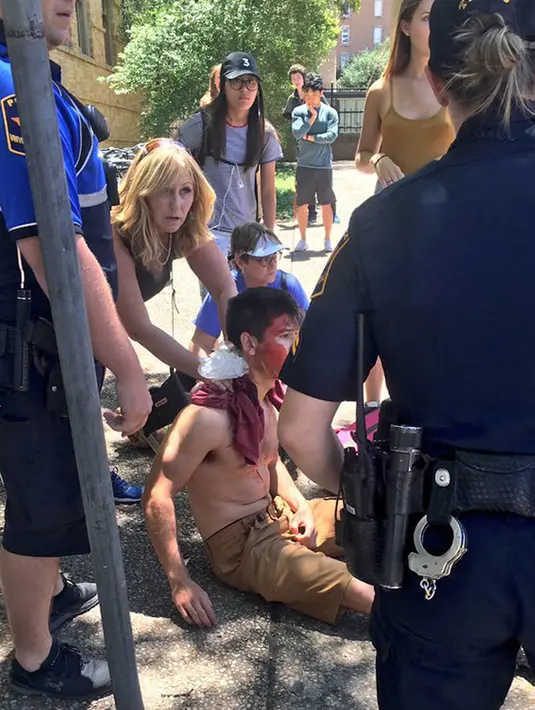 Salah satu korban mendapat pertolongan setelah insiden penusukan massal di University of Texas, Senin (1/5). Terduga pelaku dan motif serangan tersebut belum dapat diketahui karena masih dalam penyelidikan. (Tamir Kalifa/Austin American-Statesman via AP)