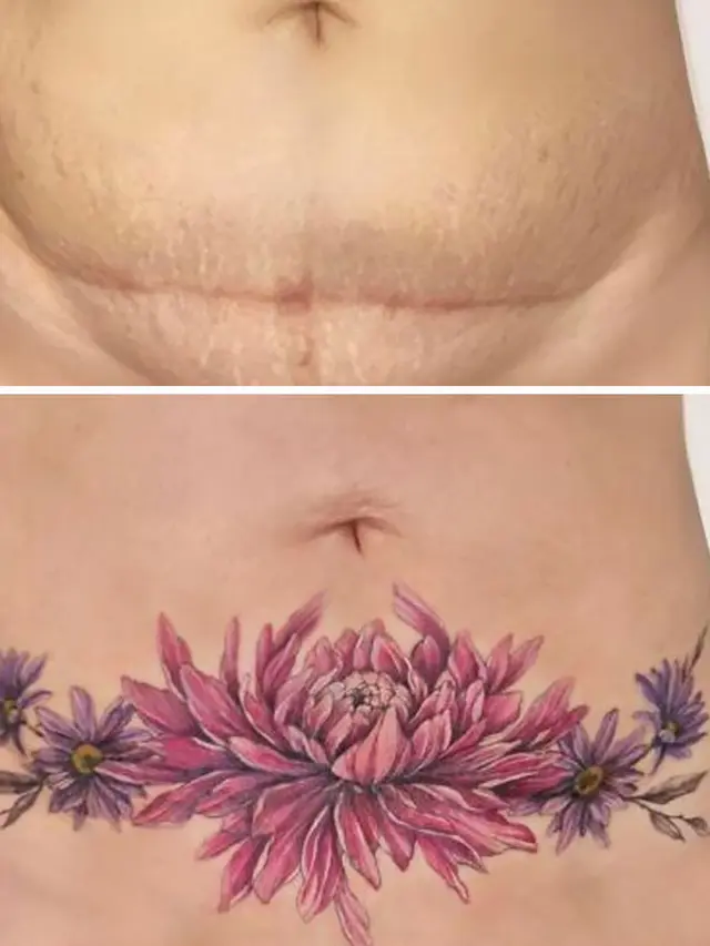 Gunakan Tato Untuk Menutupi Bekas Luka, 6 Potret Hasilnya Bikin Takjub. (Sumber: Boredpanda)