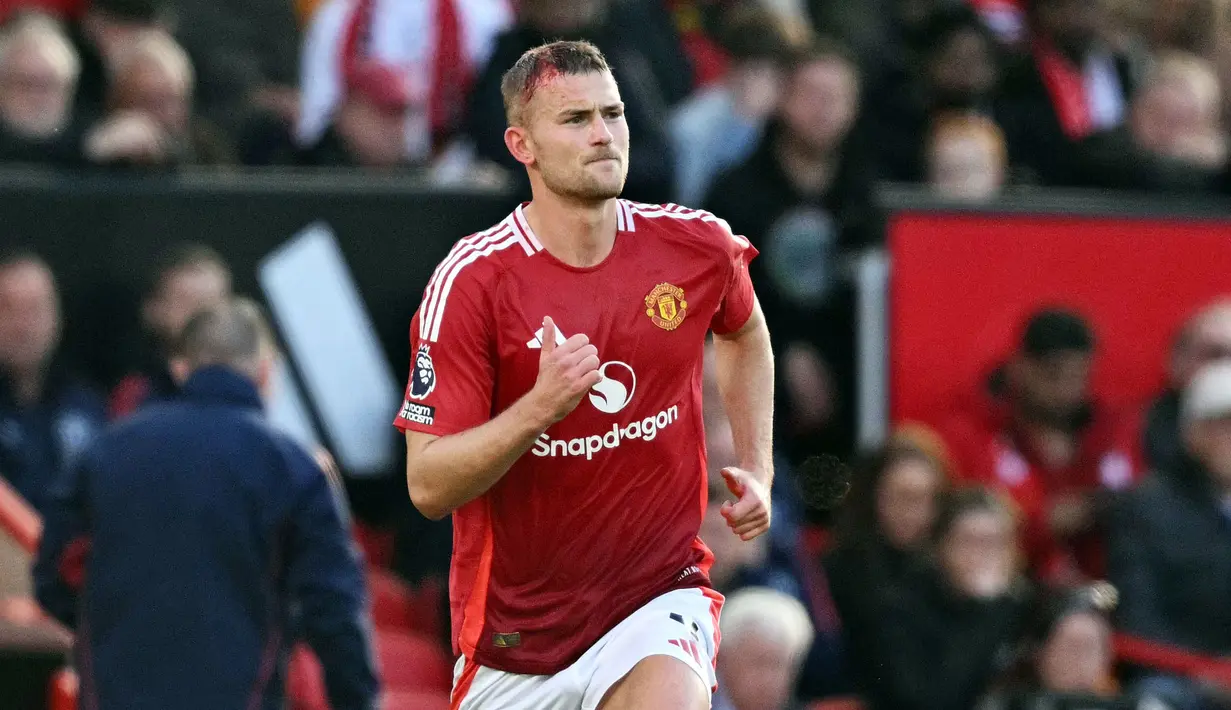 Pemain Manchester United, Matthijs de Ligt kembali ke lapangan pertandingan dengan luka di kepala setelah mendapatkan perawatan dari tim medis pada laga lanjutan Liga Inggris 2024/2025 melawan Brentford di Old Trafford, Manchester, Sabtu (19/10/2024). (AFP/Oli Scarff)