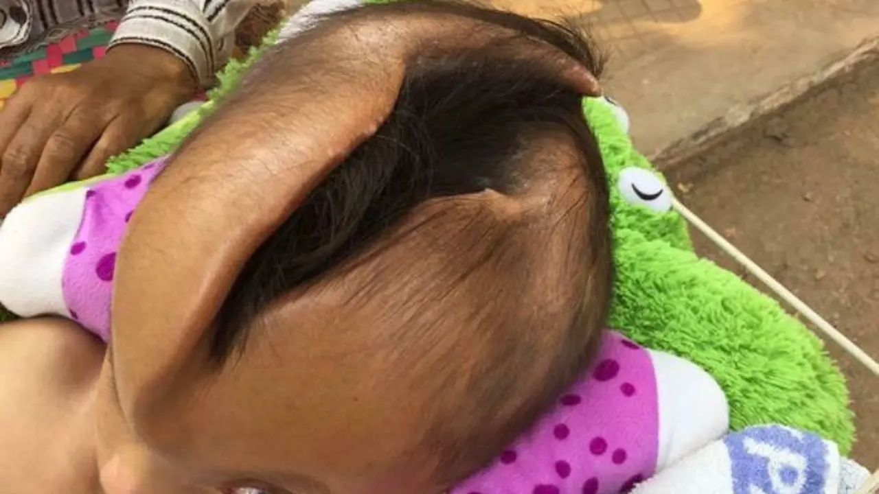 Bayi Malang Alami Retakan Misterius di Kepalanya