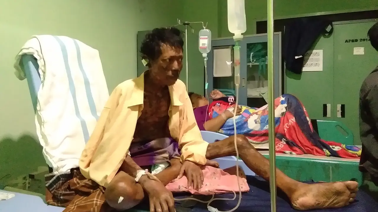 Pria dengan Tubuh Penuh Nanah