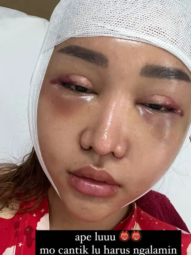 Lucinta Luna. (Foto: Dok. Instagram @lucintaluna_manjalita)