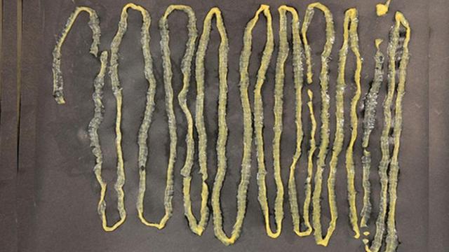 Ngeri Cacing Pita 2 8 Meter Keluar Dari Anus Pria Ini Citizen6 Liputan6 Com