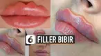 Tren baru dunia kecantikan yang kini sedang dibicarakan warganet. Filler bibir keriting sebenarnya pernah viral di 2017.